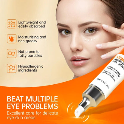 Radiant Eyes: Dark Circle & Eye Bag Brightening Cream | Wrinkle Removal Serum, Firming Skin Care